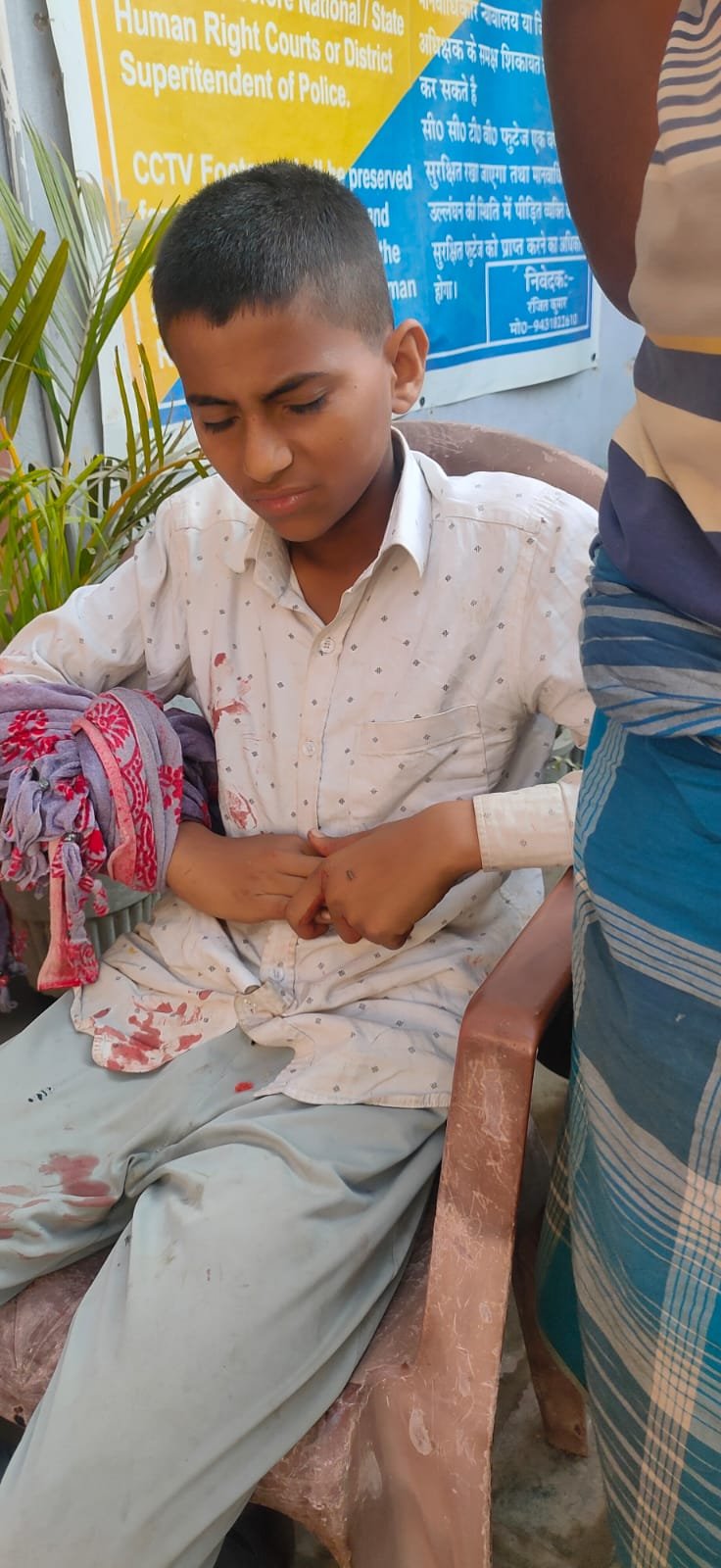 दो अपराधी गुटो के बीच गोलीबारी मे दुकान जा रहे बच्चे को लगा गोली, जख्मी।