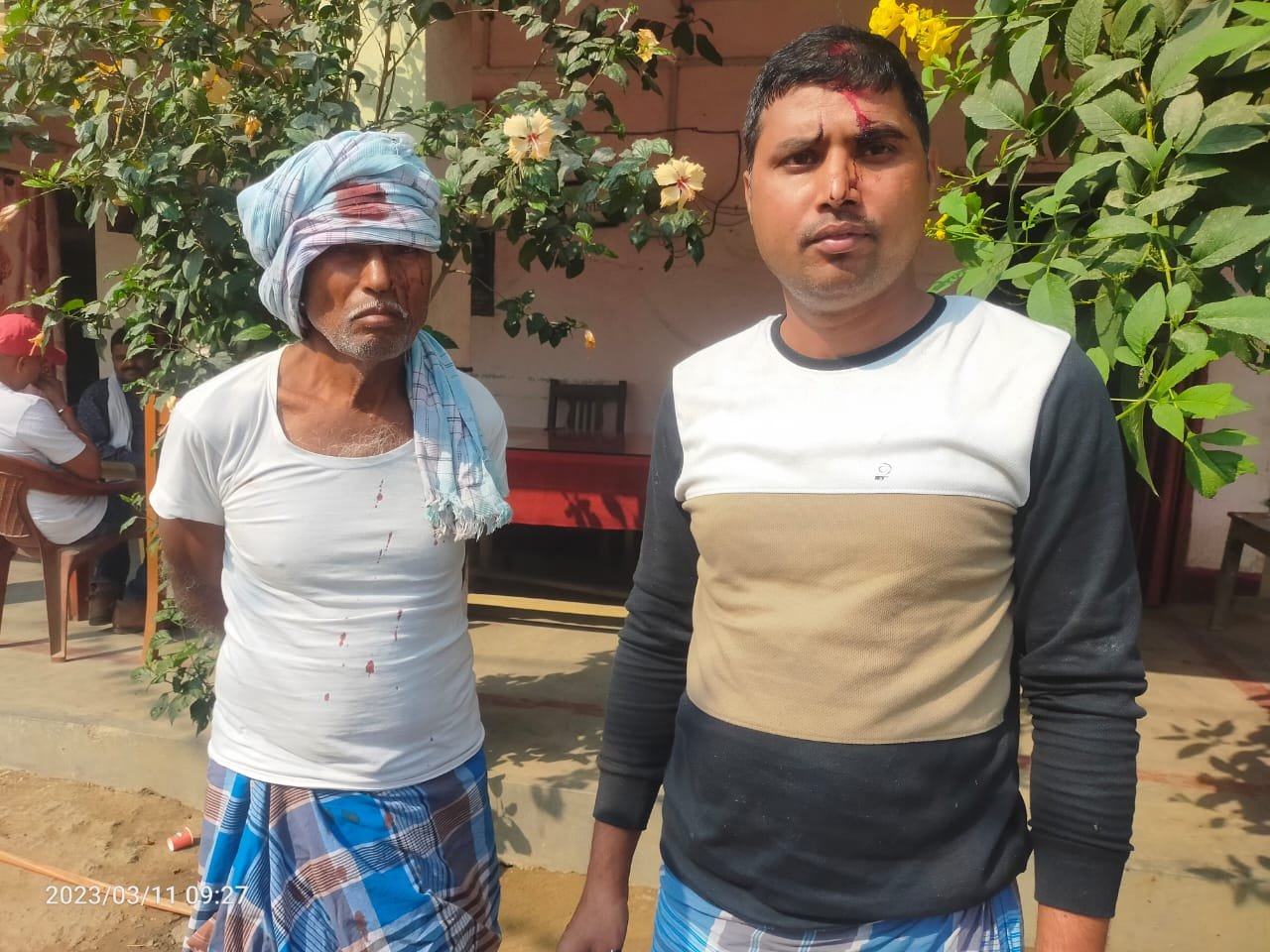 भागलपुर :जमीनी विवाद को लेकर खूब चले रॉड एवं पत्थर।