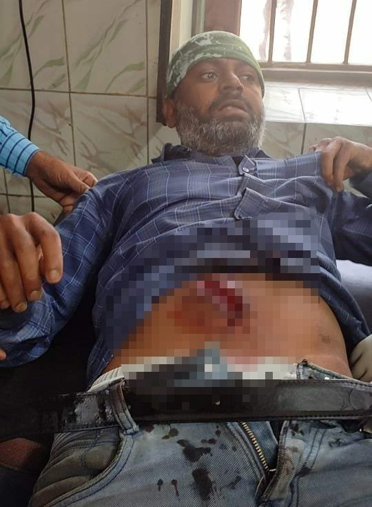 गोली मारकर युवक को किया जख्मी, छानबीन में जुटी है पुलिस